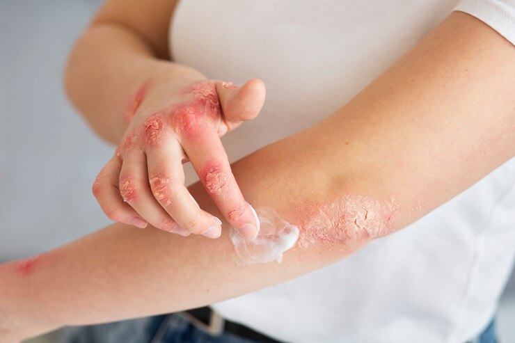 Discover Effective Homeopathy Treatments